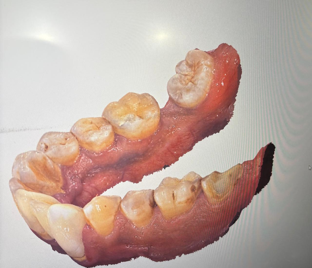 3D Smile Design 2
