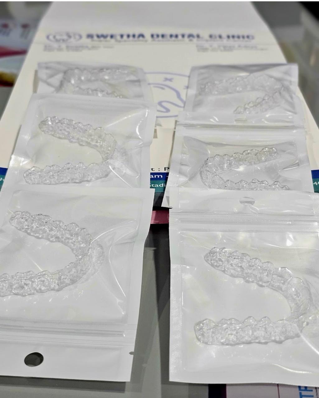 Clear Aligner 3