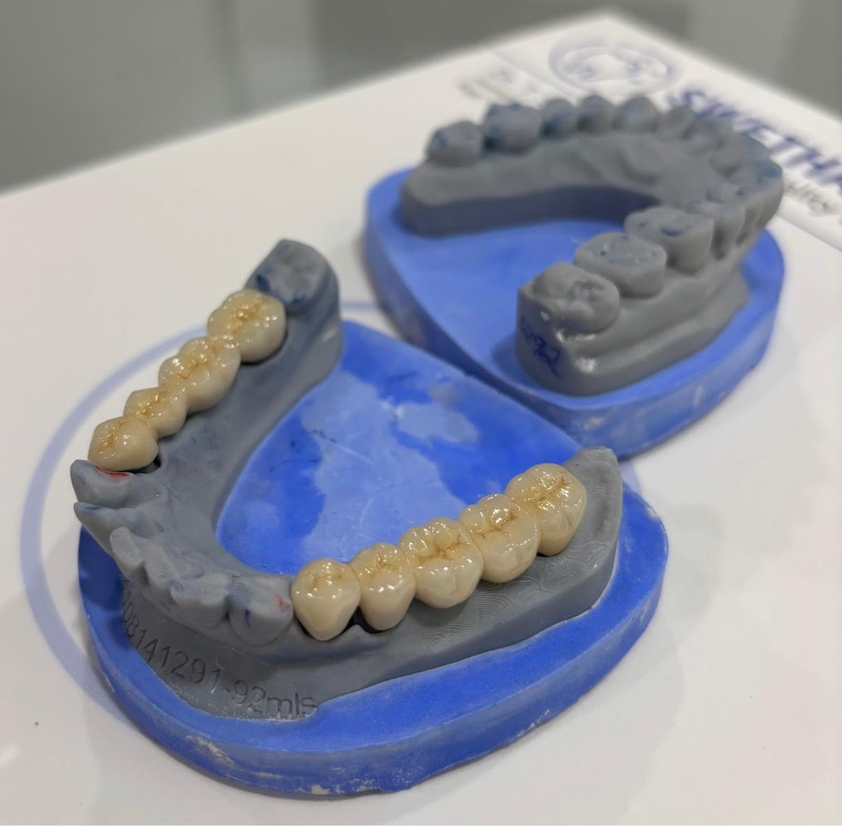 Dental Crown 4