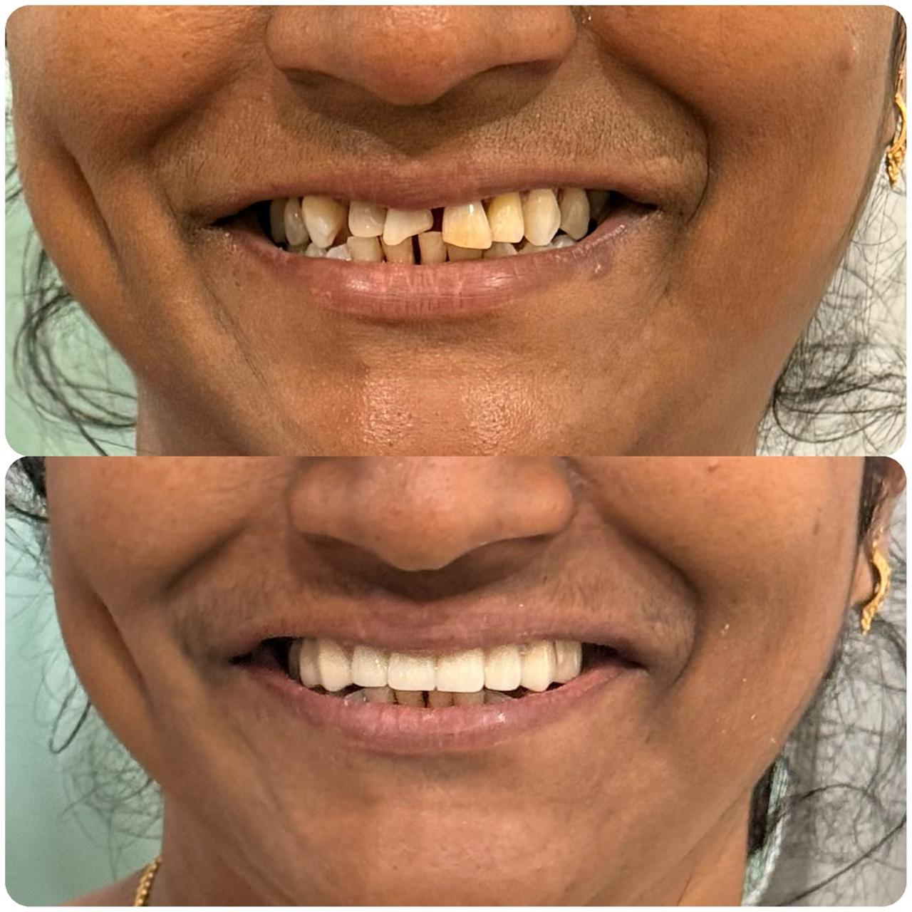 Smile Designing 1